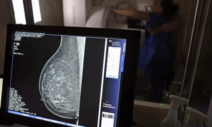 SUS amplia ações contra o câncer no Brasil