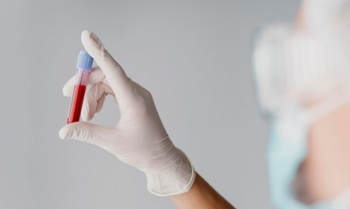 Novo exame prevê Alzheimer com alta precisão