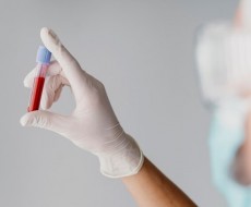 Novo exame prevê Alzheimer com alta precisão