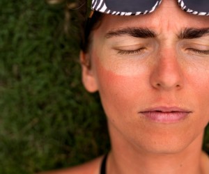 Exposição solar das férias pode deixar marcas na pele