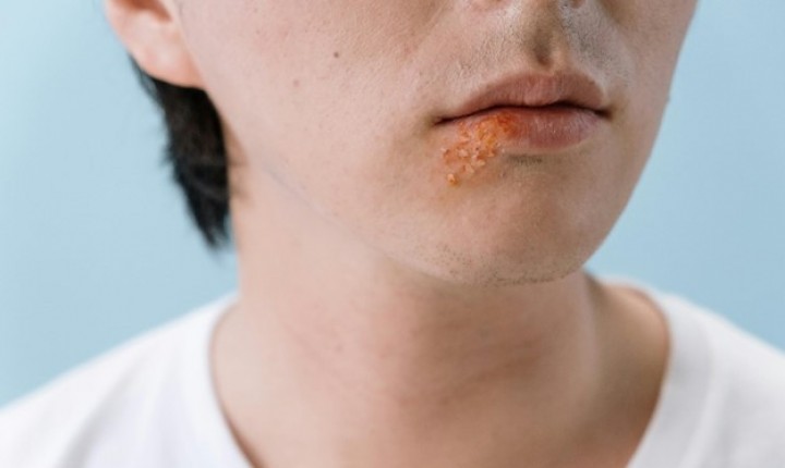 Beijos e aglomeração acendem alerta durante a folia