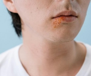 Beijos e aglomeração acendem alerta durante a folia