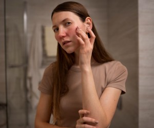 Emoções podem deixar marcas visíveis na pele