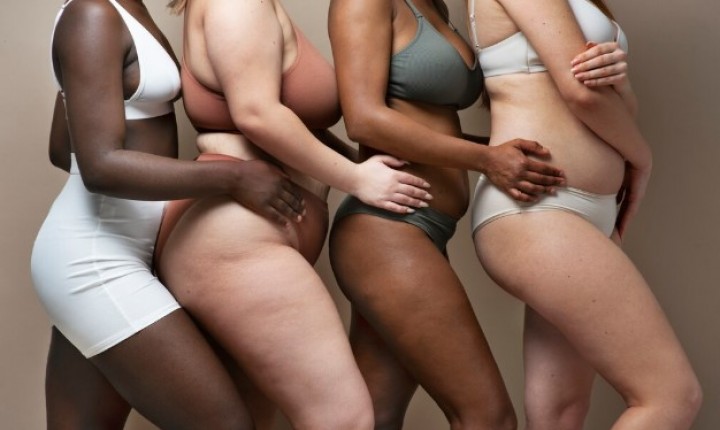 Celulite pode indicar doença além da estética
