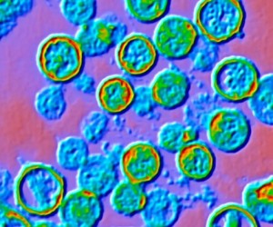 Hantavírus pode causar nova pandemia mundial?