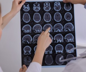 Sete sinais que podem indicar esclerose múltipla